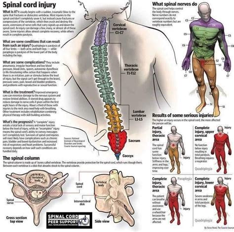 Pin By Phillip Vergara On Science In 2020 Spinal Cord Injury Spinal