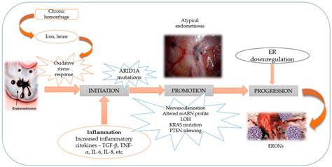However, this does not explain other cancer risk among women with endometriosis. JCM | Free Full-Text | Circulating miRNAs as Biomarkers ...