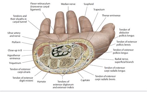 6 The Wrist And Hand Diagnostic Imaging Musculoskeletal Key