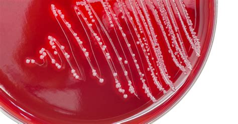 Studies Inconsistently Define Report Contaminants In Blood Cultures