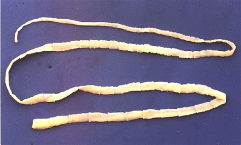 Tapeworm Beef Causes Symptoms Treatment Tapeworm Beef