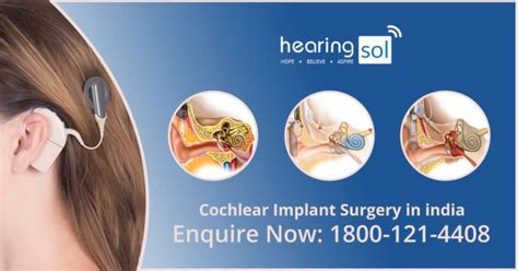 Best Cochlear Implant Surgery Center In Delhi Hearingsol