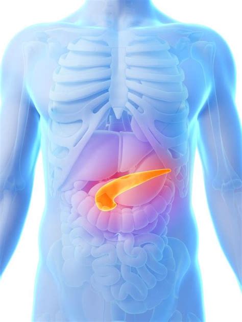 Pancreatic cancer does not always cause symptoms until the tumor has spread. Test may detect pancreatic cancer early