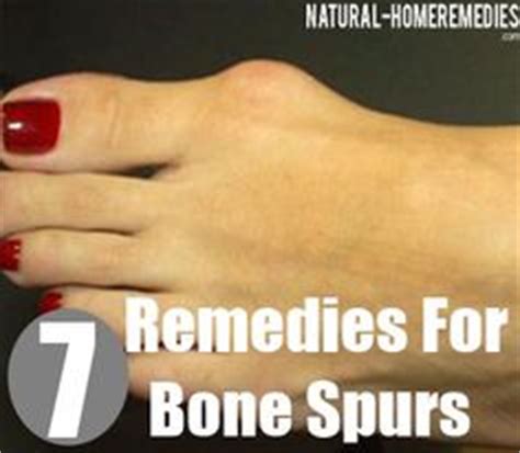 See more ideas about bone spurs, bone spurs foot, heel spurs. Do you really need that bone spur chopped off? Injury to ...