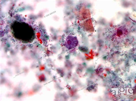 Photomicrograph The Amoeba Entamoeba Histolytica Responsible For