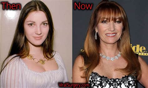 Jane Seymour Plastic Surgery Before And After Botox Pictures