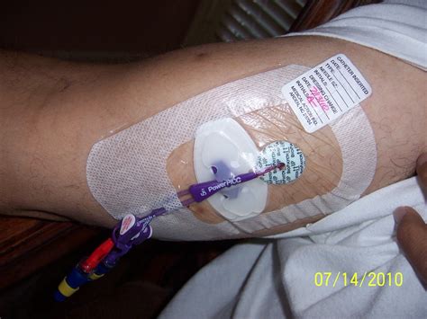 Iv Picc Line Care Provided By Paloma Home Health Agency Flickr