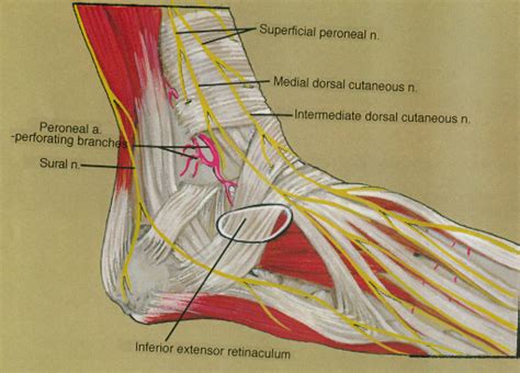 Superficial Fibular Peroneal Nerve Medial Dorsal Cut Open I