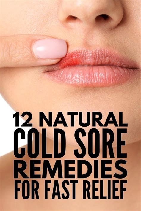 Pin By Eldenfygxb On Beauty Cold Sores Remedies Natural Cold Sore