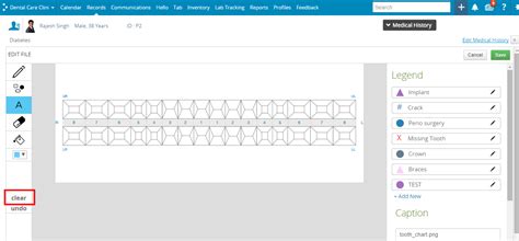 All About Dental Charting – Practo Help