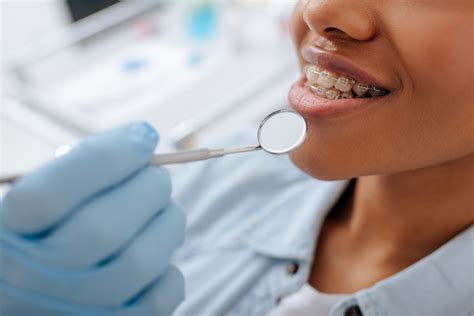 How Long Is The Nhs Braces Waiting List Didsbury Dental Practice