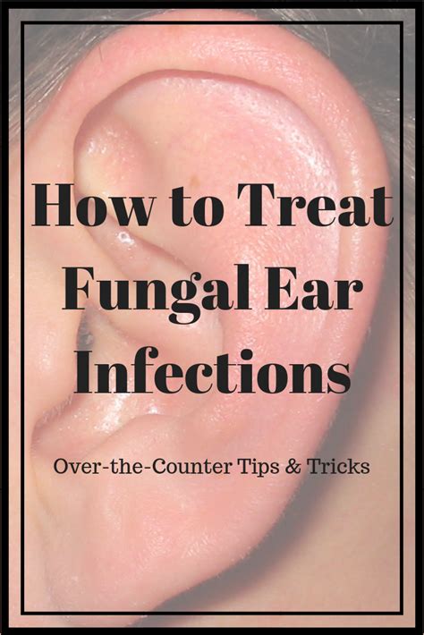 How To Treat Fungal Ear Infections Ear Infection Remedy Ear