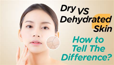 Dry Vs Dehydrated Skin How To Tell The Difference Watsons Th Blog