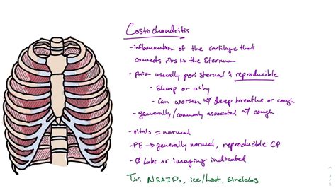 Causes Of Chest Pain Costochondritis And Anxiety Youtube