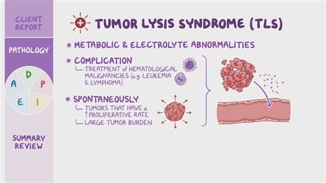 Tumor Lysis Syndrome Tls Nursing Process Adpie Osmosis Video Library