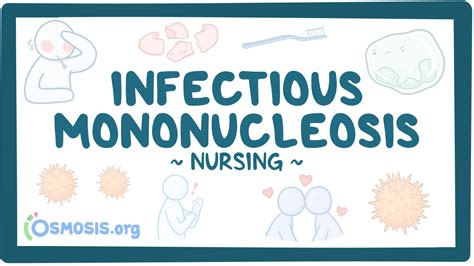 Infectious Mononucleosis Nursing Osmosis Video Library