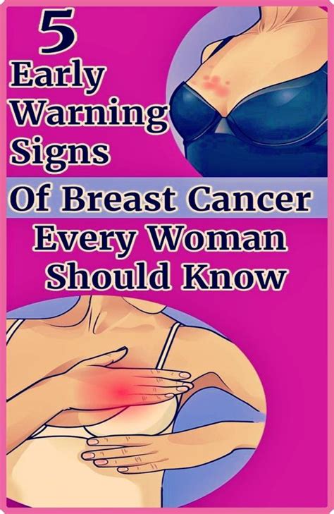 5 Warning Signs Of Breast Cancer That Many Women Ignore