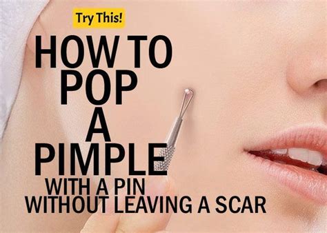 How To Pop A Pimple 5 Simple Ways To Pop A Pimple Typesofpimples