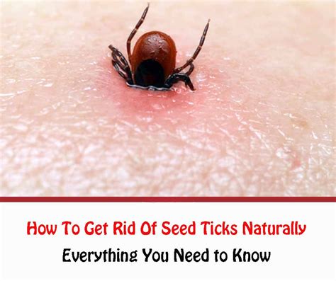 How To Get Rid Of Seed Ticks Naturally