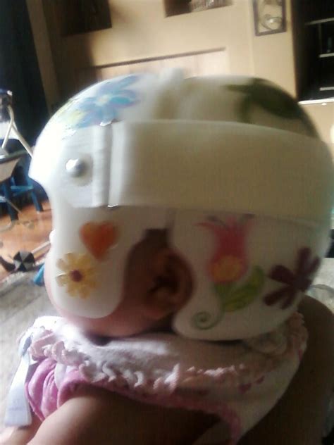 Evas Baby Helmet For Plagiocephaly Decorated On The Closure Side