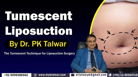 Tumescent Liposuction Surgery In Delhi India Tumescent Technique For
