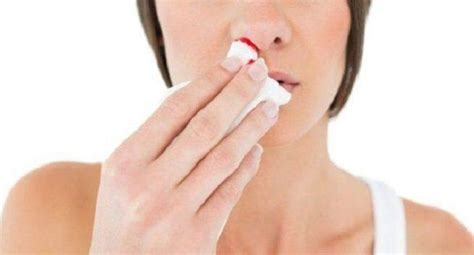 Dry Nose Home Remedies For Instant Relief Get Rid Of Your Dry Nose