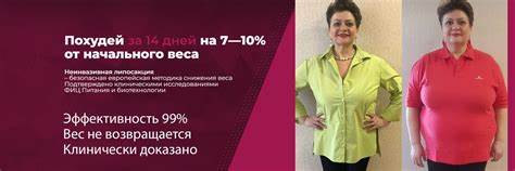 Неинвазивная липосакция - LipoDIET™ I Похудение | Действующий метод Картинка - Неинвазивная липосакция - LipoDIET™ I Похудение | Действующий метод