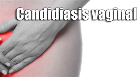 S Ntomas Y Tratamiento Para La Candidiasis Vaginal