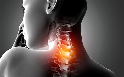 Cervical Spine C6 C7 C8 Vertebrae Spinal Cord Injury Fracture