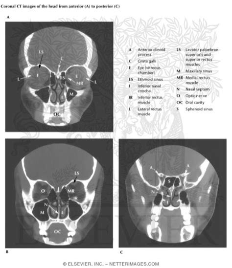 Head Scans Coronal Ct Images