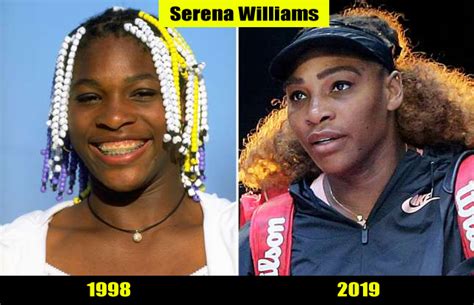 Serena Williams Then And Now