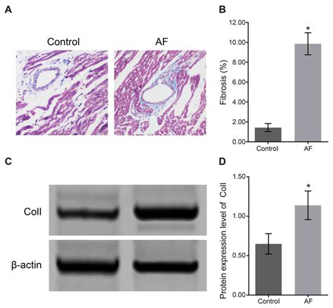 Role Of Matrix Metalloproteinase‑7 And Apoptosis‑associated Gene