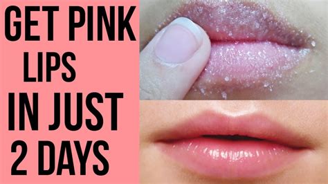 How To Get Pink Lips Lighten Dark Lips Naturally At Home Youtube