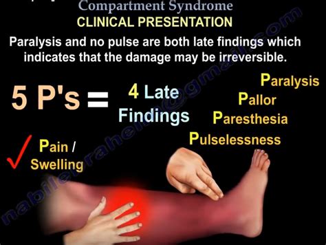 Compartment Syndrome Diagnosis And Treatment Orthopaedicprinciples Com
