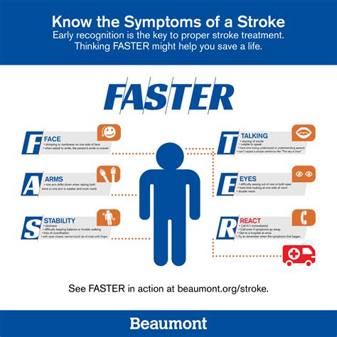 Stroke What You Need To Know Beaumont Health