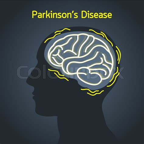 Parkinsons Disease Vector Logo Icon Stock Vector Colourbox