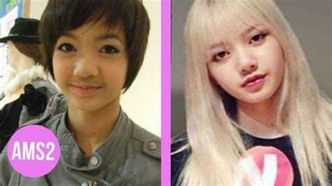 Blackpink Plastic Surgery Before And After Babaforex2020