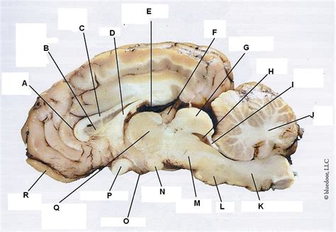 Sheep Brain Sagittal View Diagram Quizlet
