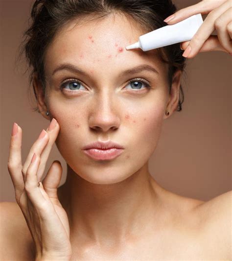 15 Best Acne Treatment In 2023 According To An Expert