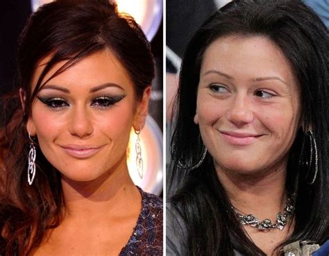 Pin By Jennifer Heine On Before And After Makeup Plastic Surgery Beauty Jwoww