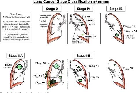Stage iv non — small cell lung cancer is very difficult to treat because it has spread to distant sites throughout the body. Figure 2 from The Eighth Edition Lung Cancer Stage ...