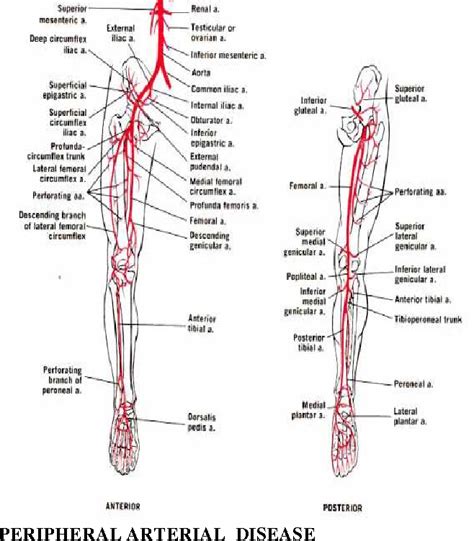 Table 1 From Lower Limb Arteries Assessed With Dopplerangiography A