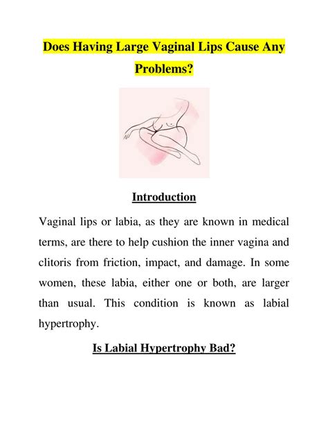 Ppt Does Having Large Vaginal Lips Cause Any Problems Powerpoint