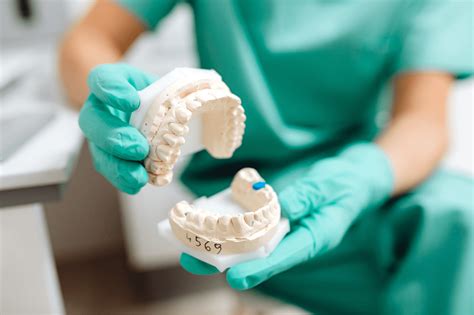 La malocclusione dentale cos è e come si cura
