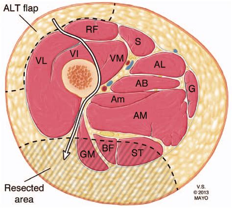 Axial Ct Anatomy