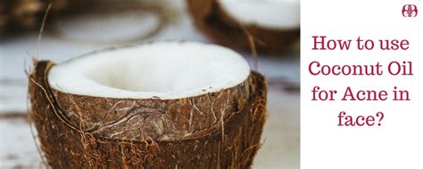 2 Quick Tips On How To Use Coconut Oil For Clear Acne At Home