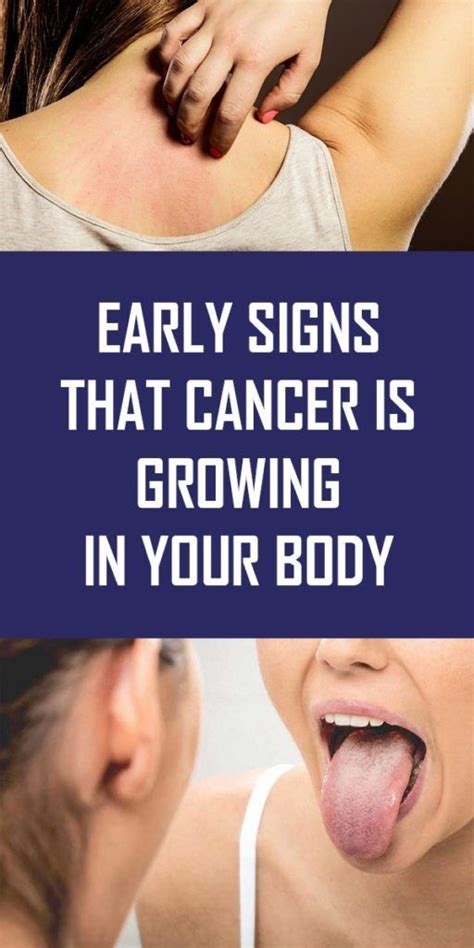 Early Signs That Cancer Is Growing In Your Body