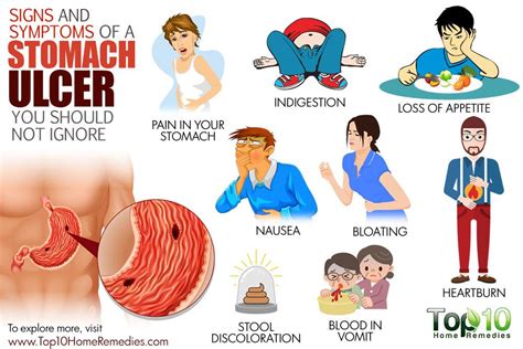 10 Signs And Symptoms Of A Stomach Ulcer You Should Not