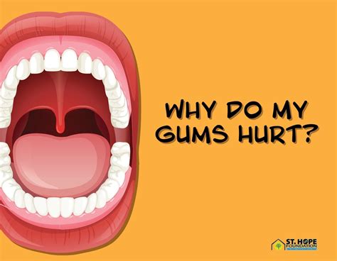 Causes And Remedies For Gum Discomfort St Hope Foundation