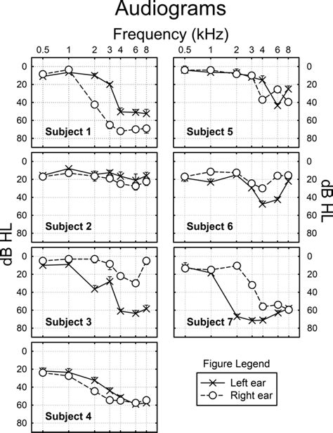 Pure‐tone Audiograms For Left And Right Ears For Each Of The Seven